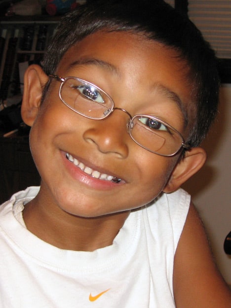 Niko, pediatric cataract surgery patient