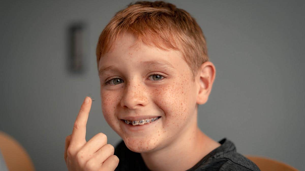 boy with contact lense