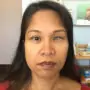 Rosemarie Domingo Before Surgery