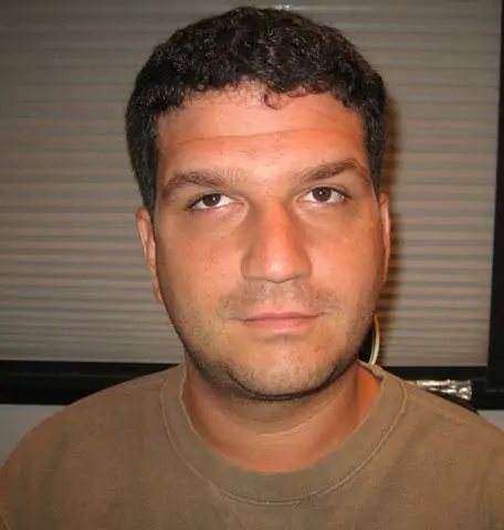 Joel Before strabismus Surgery